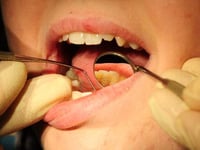 Call for urgent action over lack of West Somerset dentists