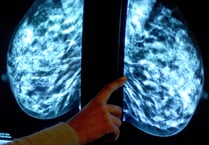 Breast screening uptake in Somerset remains below pre-pandemic levels