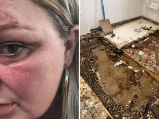Disabled mother left black and blue after floor and ceiling collapse