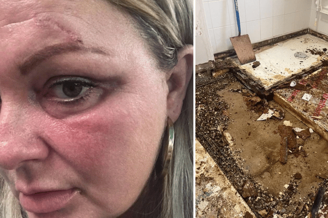 Victoria Parkhill, 45, has had the floor fall from under her and part of her ceiling fall on top of her