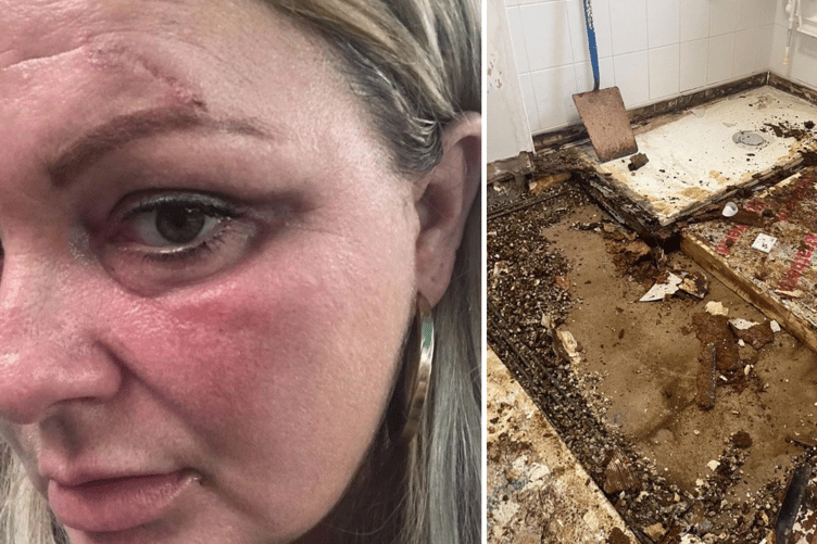 Victoria Parkhill, 45, has had the floor fall from under her and part of her ceiling fall on top of her