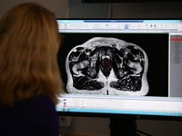 More men diagnosed with prostate cancer in Somerset
