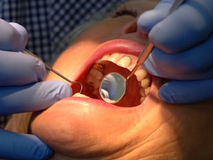  People in Somerset more likely to have access to an NHS dentist – as 'postcode lottery' sees thousands miss out