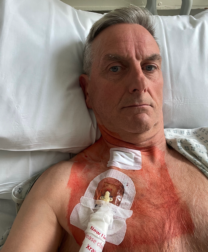 Charity cyclist Tim Blackburn undergoing treatment after his kidneys failed.